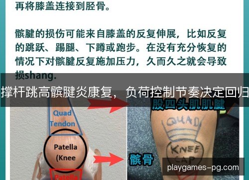 撑杆跳高髌腱炎康复，负荷控制节奏决定回归